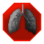 File:Acute respiratory distress syndrome.png